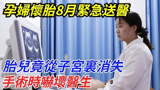 陜西孕婦懷胎8月緊急送醫，胎兒竟從子宮裏消失，手術時嚇壞醫生【流星奇聞】#奇聞#故事#奇聞觀察室#案件解讀#情感#家庭矛盾