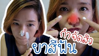 กำจัดสิว ขจัดสิวเสี้ยน ได้ผลจริงภายใน 3 นาที ด้วยยาสีฟัน