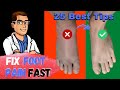 Broken Foot, Sprained Foot & Stress Fracture Treatment [25 Best Tips]