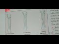 fracture classification clinical features investigation in very easy way fracture surgery