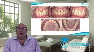 Webinar   1 The case for orthodontics in a general dental practice