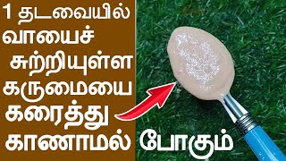 அதிசயம் ஆனால் உண்மை வாயைச் சுற்றியுள்ள கருமைக் கரையும்Remove Pigmentation, Dark patches Around Mouth