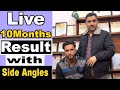 Live Results / Hair Transplant of Side angles