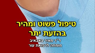 פתרון מהיר להזעת יתר: טיפול בוטוקס פשוט ויעיל | ד\