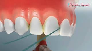 Say goodbye to cavity worries | Smiles Royale | Dentist Clinic | Mumbai| Dr. Ajay Thaker