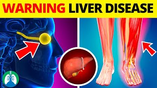 Top 10 Early Warning Signs of Liver Disease ⚠️
