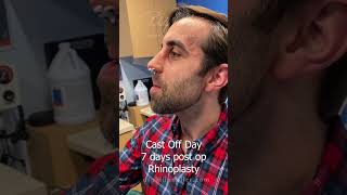 Rhinoplasty Results Progress Over Time! Trust the Process!