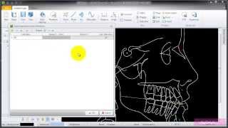 AudaxCeph - instructions for automatic superimposition