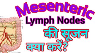 🌺आंत की नोड में सूजन🌺Mesenteric lymph nodes Swollen🌺 Homeopathic Medicine🌺