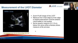 ASE 2021 Aortic Stenosis