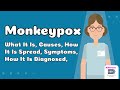 Monkeypox - What It Is, Causes, How It Is Spread, Symptoms, How It Is Diagnosed, Treatments & More