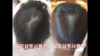 탈모샴푸 만들기 3가지만 있으면 됩니다. DIY shampoo