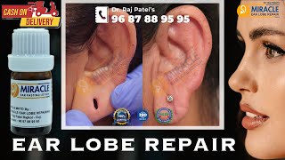 Earlobe / Hole Repair By Ear Pasting lotion / Ear Repair/ Torn Ear lobe Repaired Earlobe -9687889595