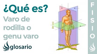 VARO DE RODILLA | Qué es, causas, síntomas, a quién afecta y tratamiento