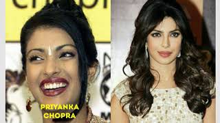 20 Bollywood Actresses Shocking Transformation 2018 | 2018 Then And Now