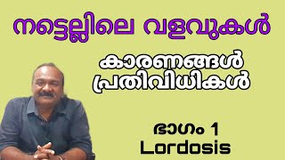 നട്ടെല്ലിലെ വളവുകൾക്ക് ഉള്ള കാരണങ്ങളും പ്രതിവിധികളും |Abnormal Curves of Spine | Lordosis