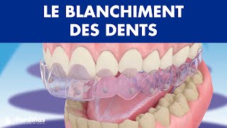 Blanchiment dentaire ©