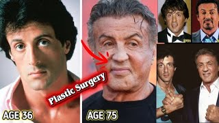 Sylvester Stallone Plastic Surgery Reported jaw and facial changes