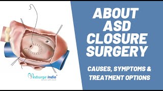 ASD Closure Surgery | Atrial septal defect (ASD) Causes, Symptoms & Treatment