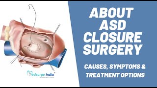 ASD Closure Surgery | Atrial septal defect (ASD) Causes, Symptoms \u0026 Treatment