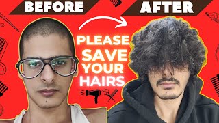 PLEASE SAVE YOUR HAIRS | HAIRLOSS MISTAKES | GANJE HO JAOGE  #hairfall #hairloss #menhaircuts #hair