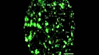 NeuroPak: Calcium activity of hippocampal neurons on a freely moving mouse