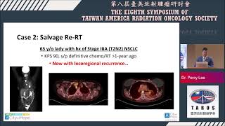 601Percy and Steven 16 25 17 25 Difficult cases in thoracic cancers