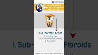 what is uterine fibroid, types of fibroids  and best treatment