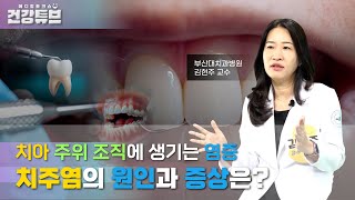 [KNN건강튜브]  방치하면 큰일 난다! 치주염의 증상은?