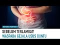 4 Gejala Usus Buntu yang Harus diwaspadai | Deteksi Penyakit