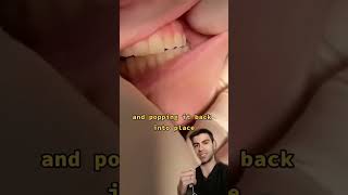 She Dislocated Her Mouth