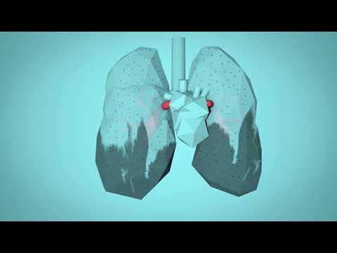 Which group of people will air pollution affect the most?