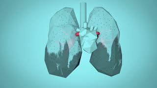 WHO: Breathe Life - How air pollution impacts your body