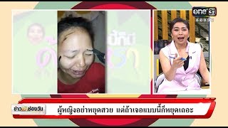 ผู้หญิงอย่าหยุดสวย แต่ถ้าเจอแบบนี้ก็หยุดเถอะ | แบบนี้ก็มีด้วยหรา | ข่าวช่องวัน | ช่อง one31