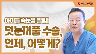 어린이 속눈썹 찔림 수술, 언제 해야 하나요?