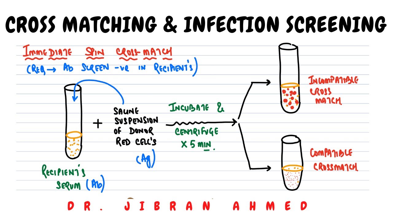 CROSS MATCHING AND SCREENING OF INFECTIONS II HEMATOLOGY II BLOOD ...