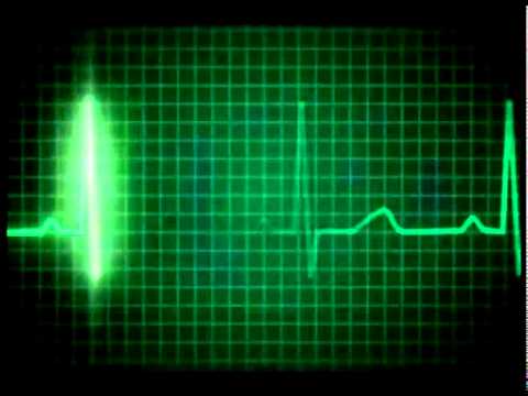 Heart Rate Monitor.mov Heart Rate Monitor.mov