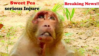 Breaking News! Poor Sweet Pea Monkey Met Accident! What is your wish for monkey Sweet Pea?