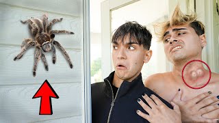 A Spider BITES My Brother!