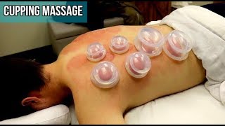 Pro Cupping Massage Techniques