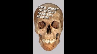 Słynne „wampiry” z Gliwic zostały zbadane przez dentystów  #archeologia #średniowiecze #Gliwice