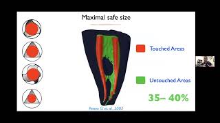 CE Webinar: Anatomically Driven Endodontics with Dr. Chafic Safi and XP-3D from Brasseler USA