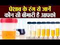 Urine के रंग से जानें कौन सी बीमारी है आपको | Urine Color Reveal Health Issues | Boldsky