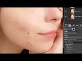 how to retouch blemishes like a pro in gimp