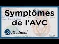 Quels sont les signes d'un AVC : AVC symptômes et AVC séquelles