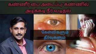 கண்ணீர்ப்பை அடைப்பு கேள்விகளும் தீர்வும்.Tear duct block and frequent watering of eyes, explained.