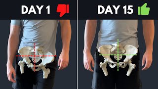 The Best Resource On The Internet For Fixing Lateral Pelvic Tilt (asymmetrical hips)