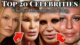 20 Celebrities Who Are Unrecognizable Today 2024