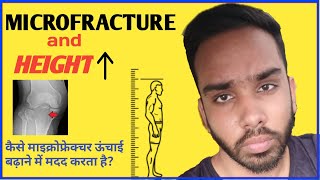 Microfracture and height (ऊंचाई) growth | हाइट बढ़ाने का तरीका