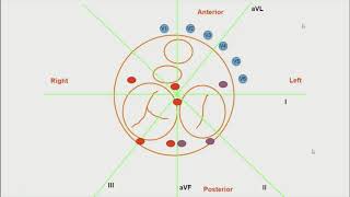 Localization of accessory pathway - Dr Mukund A Prabhu  | ECG in Syncope - Dr Praveen Sreekumar